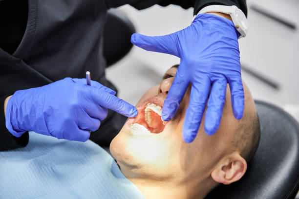 Best Emergency Dental Extractions in Montrose, PA